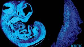 Scientists find 'battle of the sexes' begins before birth