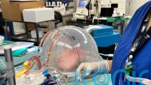 Scientists convert lungs to universal blood type in step towards neutral organ transplants