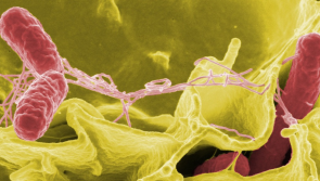 ALERT: Risk of salmonella infection prompts immediate recall of popular snack food