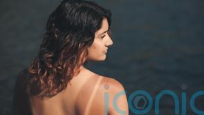 EXPLAINER: 5 sunburn myths we need to stop believing