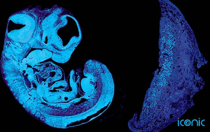 Scientists find 'battle of the sexes' begins before birth