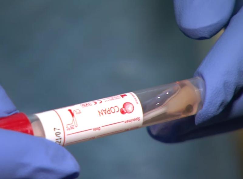 Figures for hospital and ICU patients with Covid-19 drop again despite high infection rate