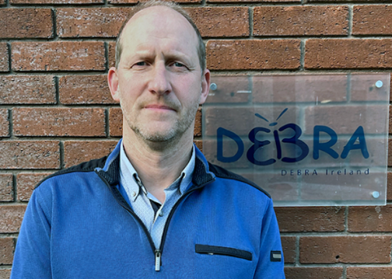 Irish people suffering with painful rare condition need mental health aid, charity says