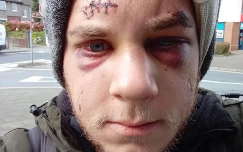 Fundraiser raises thousands for Croatian man left with brain bleed after friend killed in Dublin