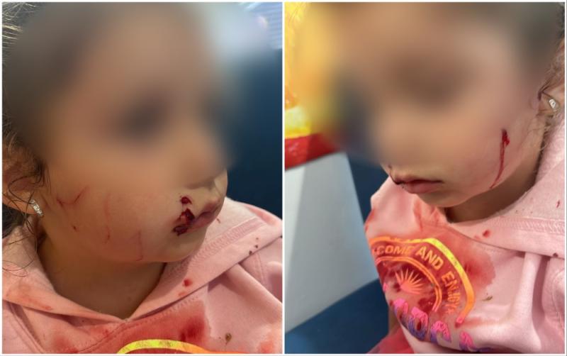 'We're in shock' - Horror cat attack in Longford leaves 3 year-old girl scarred